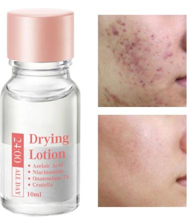 Spot Lotion 10 ml Drying Solution for Spots and Moisturizers | Fast-Acting Liquid for Facial Blemishes for Women for Daily and Nighttime Use Travel and - Buy Online on GoSupps.com