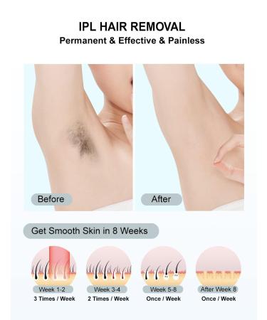 At-Home IPL Laser Hair Removal Device - 999 999 Flashes Painless Hair Remover for Men & Women | Face Legs Arms Bikini Line - Buy Online on GoSupps.com