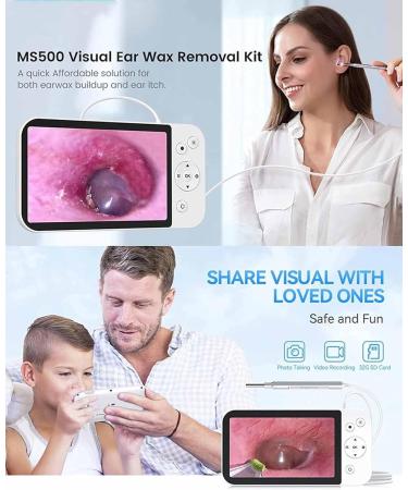 HSRG 5-Inch Portable LCD Photo Camera & Ear Cleaner 1080p HD 3.9mm Ear Wax Removal Tool Video Recording & Photo Storage International Shipping Available - Buy Online on GoSupps.com