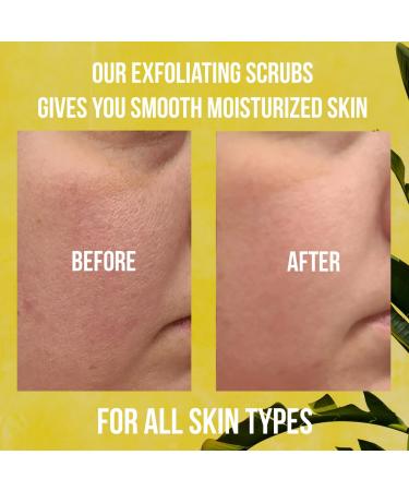 Organic Banana Body Scrub | Moisturizing & Exfoliating Salt Scrub | Fights Stretch Marks & Fine Lines | Pure Skin Care Exfoliator - Buy Online on GoSupps.com