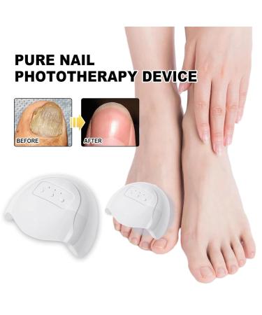 Szutfidy Infrared Nail Treatment Tool | Fungal Infection Prevention & Blue Light Therapy for Toenail & Fingernail Care - Home Use Nail Fungus Remover - Buy Online on GoSupps.com