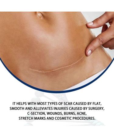 Silicone Skin Renewal Gel - Women's Treatment for Surgical Scars, Stretch Marks, Acne, Burn Scars & Pockmarks - 1pcs - Buy Online on GoSupps.com