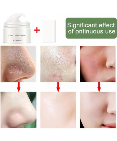AQSQWQ Blackhead Remover Face Mask Charcoal Pore Cleansing Mask Nose Mask Peel Off Mask for Removing Blackheads on Face and Nose (30g 1.05oz) - Buy Online on GoSupps.com