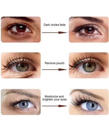 Verfons Firming Eye Cream - Anti-Aging Solution for Dark Circles Bags & Fine Lines | International Shipping - Buy Online on GoSupps.com