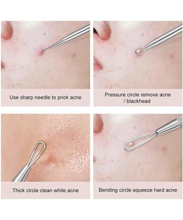 Blackhead Remover 2 PCS Pimple Popper Tool Stainless Steel Pimple Extractor Blackhead Removal Tool Risk Free Treatment for Blemish Whitehead Popping Blemish - Buy Online on GoSupps.com