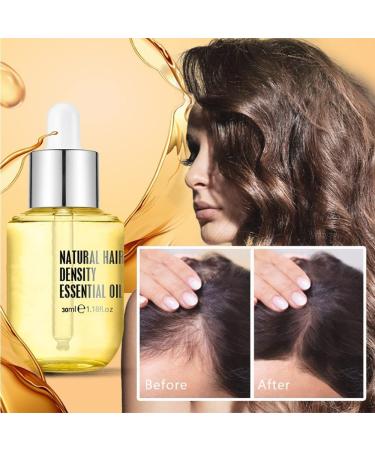 2023 Hair Growth Essential Oil - Natural Regrowth Formula for Men & Women - Buy Online on GoSupps.com
