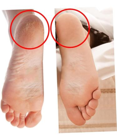 minkissy 6 Pairs Heel Socks for Cracked Heels Heel Protectors for High Heel Shoes Moisturizing Sleeves Foot Softening Socks Silicone Heel Cover Moisturizing Socks Anti Slip Socks Increased - Buy Online on GoSupps.com