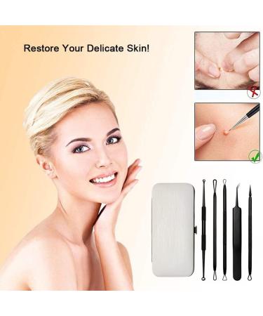 Freshn Acne Needle - Stainless Steel Blackhead Remover Tool for Effective Pimple & Pore Treatment | 1 Piece Acne Squeeze Eliminator - Buy Online on GoSupps.com