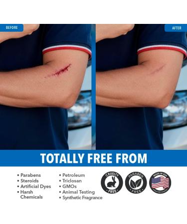 Dr. Robaina ACETOLIA First Aid Spray Antiseptic Spray for Cuts Burns & Scrapes | Tea Tree Arnica Rosemary & Chamomile Soothe & Cleanse | Steroid-Free Alcohol-Free | Made in USA | 2 fl oz 1 Unit - Buy Online on GoSupps.com