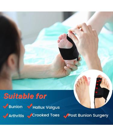 Bunion Corrector for Women - Copper Compression Splint & Brace for Big Toe Straightening (2PC - Buy Online on GoSupps.com