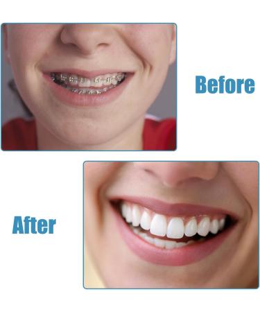 Syeycw 12-Piece Toothbrush Set for Braces Tufted Insert Brushes for Orthodontic Cleaning - Buy Online on GoSupps.com