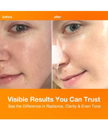 NIGHTINGALE C-TONING VITAMIN C SERUM For Face Anti Aging and Skin Brightening with Vitamin C Niacinamide Hyaluronic Acid Vitamin E Adenosine Reduces dark Spots uneven skin Tone 1.69fl.oz(50ml) - Buy Online on GoSupps.com