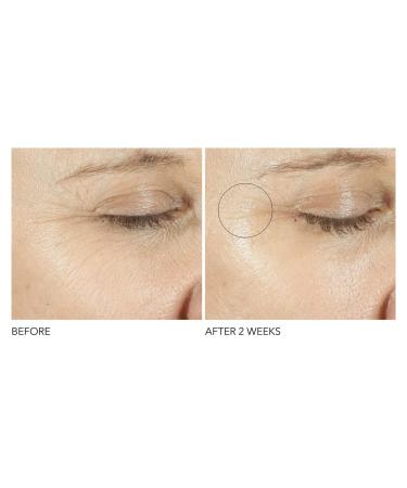 Dr. Dennis Gross Retinol + Ferulic Eye Serum for Firm Skin, Hydration, Wrinkle Reduction - 0.5 oz - Buy Online on GoSupps.com