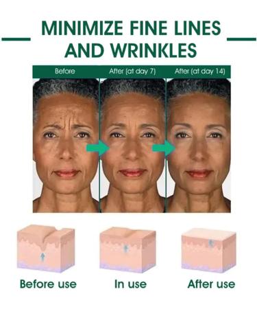 Useful Skin Firming Rejuvenating Serum Useful Skin Firming Serum Skin Firming Serum Lifting and Firming Useful Hyaluronic Acid For All Skin Types (80ML) - Buy Online on GoSupps.com