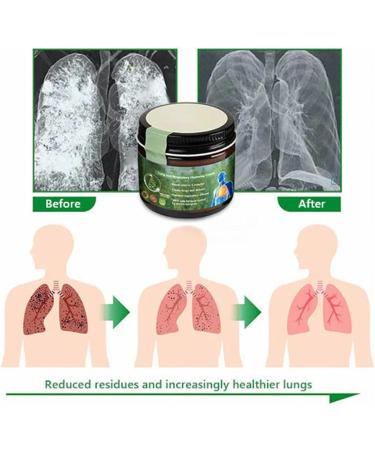 Anshka Mullein Clear Lung Repair Cream Chest Rub for Lung Health & Respiratory Support Unisex 3 Pack - Buy Online on GoSupps.com