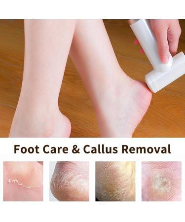 Electric Callus Remover with Quartz Stone Grinding Head 2000 mAh Rechargeable Callus Remover Foot Portable Foot Callus Remover - Buy Online on GoSupps.com