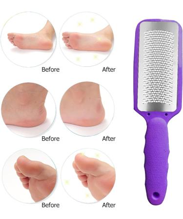Purple Foot Rasp: Callous Remover & Foot Exfoliator for Smooth Feet | Pedicure Foot File for Dead Skin Removal - Buy Online on GoSupps.com