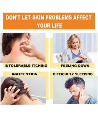 LONGLUAN Youth Bee Venom Anti-Itch Psoriasis Treatment Cream - 2Pcs Set | Soothing & Moisturizing Formula for All Skin Types - Buy Online on GoSupps.com