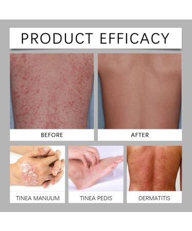 QINGZHI Plant Body Care Cream Gentle Anti-inflammatory Anti-itching and Moisturizing Cream - Buy Online on GoSupps.com