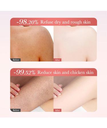 Crsetmyth Whitening Watermelon Moisture Cream 250 ml Watermelon Facial Cream Moisture Dispensing & Lightening Creme Skin Care ber Nacht Moisture Cream for Facial Skin Care Glatte - Buy Online on GoSupps.com