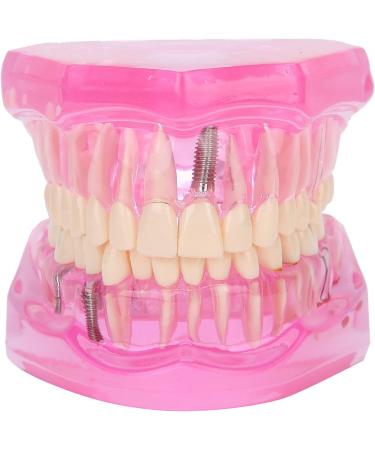 Dentalmodell f r Erwachsene - Klar Zahnmodell f r Studium & Unterricht | Internationaler Versand - Buy Online on GoSupps.com