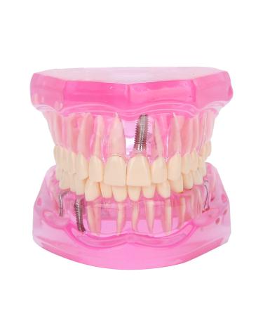 Transparent model for adult teeth pathological removable teaching repair to study dental tools in standard size