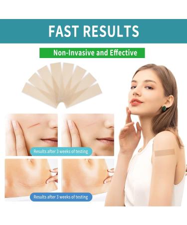 Sialicess Reusable Silicone Scar Strips for Keloid & Hypertrophic Scars - 2 Month Supply - 4 PCS - Buy Online on GoSupps.com