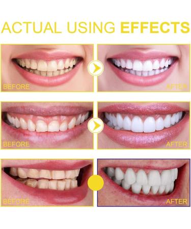 Furzero Propolis Smile Mouthwash 60ml (2pcs) - Natural Oral Care for Fresh Breath | International Shipping Available - Buy Online on GoSupps.com