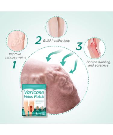 Remove Varicose Veins 16 Pcs Spider Vein Patch | Effective Treatment for Legs Care - Buy Online on GoSupps.com