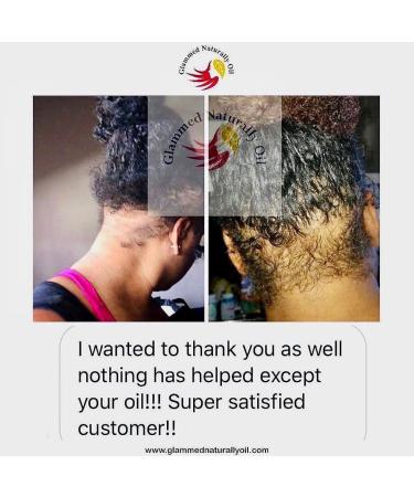 Glammed Naturally Hair Growth Oil - 100% Natural 2oz for Kids, Teen, Adult - Buy Online on GoSupps.com