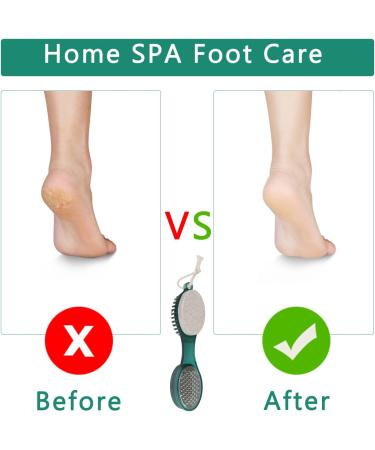 Unaone 4 in 1 Foot File Pedicure Kit - Callus Remover & Manicure Tool for Home Foot Care - Green - Buy Online on GoSupps.com