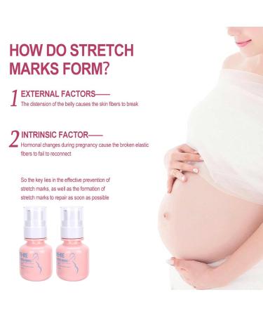 2-Piece 40g Postpartum Stretch Mark Cream | Natural Scar Fading & Nourishing Massage Cream for Women - Buy Online on GoSupps.com