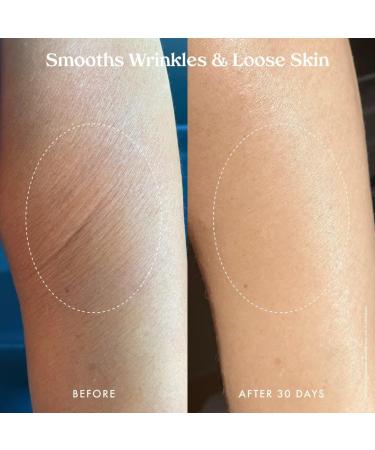 Kopari Ultra Renewal Retinol Body Cream Infused with Acai & Encapsulated Retinol Treat Fine Lines & Crepey Skin Resurface & Boosts Collagen 4.7 oz - Buy Online on GoSupps.com