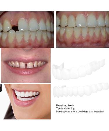 Snap On Veneers: Temporary Denture Teeth for Teeth Restoration - 2PCS - Buy Online on GoSupps.com