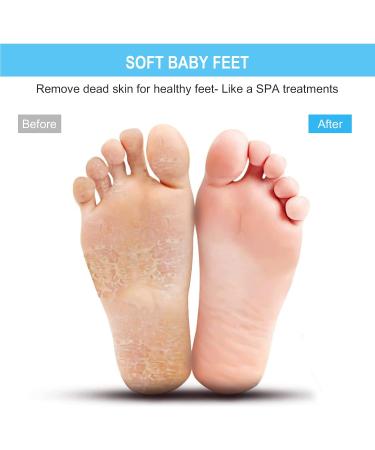 BESKAR XL Shower Foot Scrubber - Non-Slip Suction Cups - Exfoliates, Cleans, and Massages Feet - Improve Circulation & Soothe Tired Feet - Buy Online on GoSupps.com