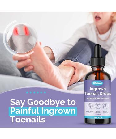 Ingrown Toenail Treatment & Pain Reliever - Softens for Easy Trimming | 30ml - Buy Online on GoSupps.com