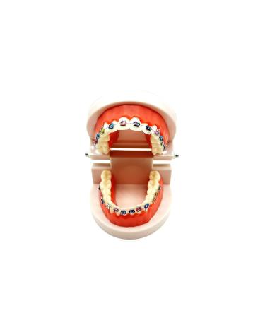 Dental Orthodontic Model with Metal Brackets and Arch Wire - Standard Teeth Model with Braces for Demonstration - Buy Online on GoSupps.com