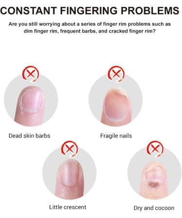 Huile De Soins Des Ongles Huile De Cuticule Renforcement Naturel Des Ongles Avec Revitalise Les Cuticules S ches Renforce Et Prot ge Ongles 15ml Pour Les Femmes - Buy Online on GoSupps.com