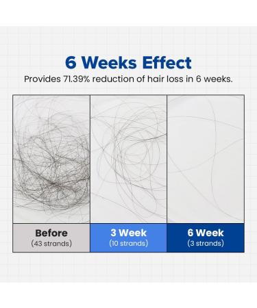 Biotin Peptide Hair Regrowth Shampoo for Hair Loss | Thickens & Strengthens | 18.59 fl oz | International Shipping - Buy Online on GoSupps.com