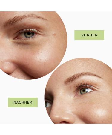 Reusable Eye Pads & 5ml Serum - Anti-Aging Puffiness & Wrinkle Reduction - Award Winner 2022 - 100% Medical Silicone - Made in Germany - Buy Online on GoSupps.com