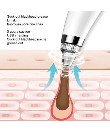 Qukaim Blackhead Removal Instrument Electric Blackhead Removal Suction Instrument Face Pore Acne Cleaner White - Buy Online on GoSupps.com