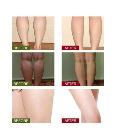 60PCS Herbal Foot Cleansing Soak Beads - Ginger Foot Soak for Lymphatic Drainage, Slimming, and Relaxation - Foot Reflex Zones Massage for Fatigue Relief - Buy Online on GoSupps.com