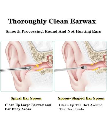 2023 Professional Stainless Steel Ear Wax Removal Kit - 6pc Spring Earwax Cleaner Tool Set (Blue) - Buy Online on GoSupps.com