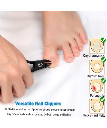 FERYES Large Handle Stainless Steel Toe Nail Clippers for Thick, Ingrown Nails - Black Olecranon Fingernail Clipper - Buy Online on GoSupps.com