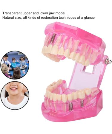 Dentalmodell f r Erwachsene - Klar Zahnmodell f r Studium & Unterricht | Internationaler Versand - Buy Online on GoSupps.com