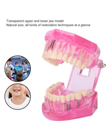 Transparent Adult Teeth Model - Pathological Removable Dental Teaching Tool Standard Size - Ideal for Study & Repairs - Buy Online on GoSupps.com