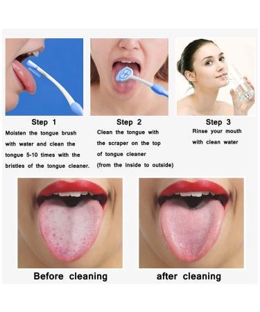 Fezf 6-Piece Tongue Cleaning Brush Set | Effective Tongue Scraper for Plaque Removal | Professional Oral Care - Buy Online on GoSupps.com