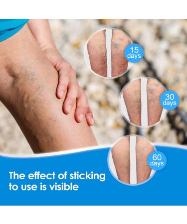 Surakey Varicose Vein Patch - Spider Vein Repair & Circulation Booster | Effective Relief for Varicose Veins & Spider Veins - Buy Online on GoSupps.com