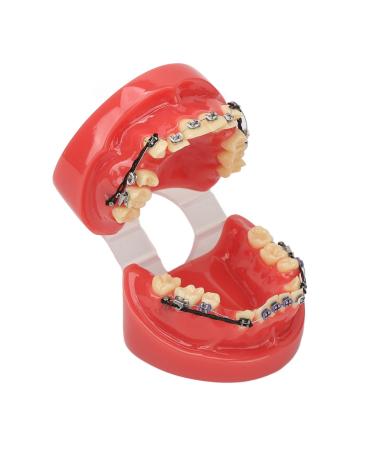 Orthodontic demonstration model professional dental orthodontic demonstration model with metal wires and bracket for lessons and learning
