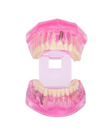 Transparent Adult Teeth Model - Pathological Removable Dental Teaching Tool Standard Size - Ideal for Study & Repairs - Buy Online on GoSupps.com